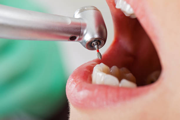 Best Pediatric Emergency Dentist in New Paris, IN